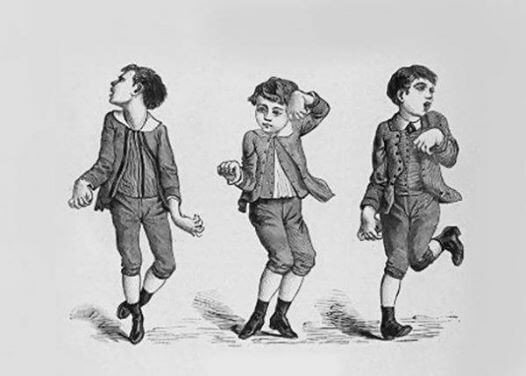 BỆNH HUNTINGTON: BỆNH DI TRUYỀN THOÁI HÓA THẦN KINH NGUY HIỂM CẦN NHẬN BIẾT SỚM