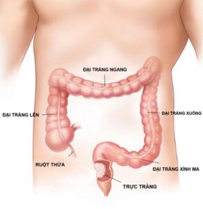 TỔNG QUAN BỆNH LÝ ĐẠI TRÀNG: NGUYÊN NHÂN – TRIỆU CHỨNG – ĐIỀU TRỊ – PHÒNG TRÁNH