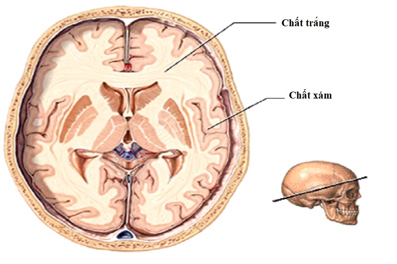 HỘI CHỨNG NÃO CHẤT TRẮNG: NGUYÊN NHÂN, TRIỆU CHỨNG, CHẨN ĐOÁN VÀ ĐIỀU TRỊ TOÀN DIỆN